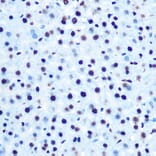 Immunohistochemistry - Anti-IRS1 (phospho Ser612) Antibody (A11031) - Antibodies.com