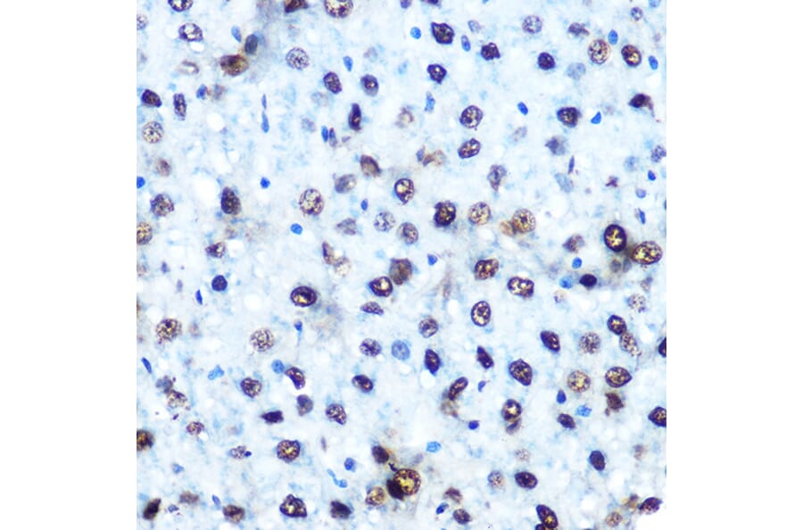 Immunohistochemistry - Anti-IRS1 (phospho Ser612) Antibody (A11031) - Antibodies.com
