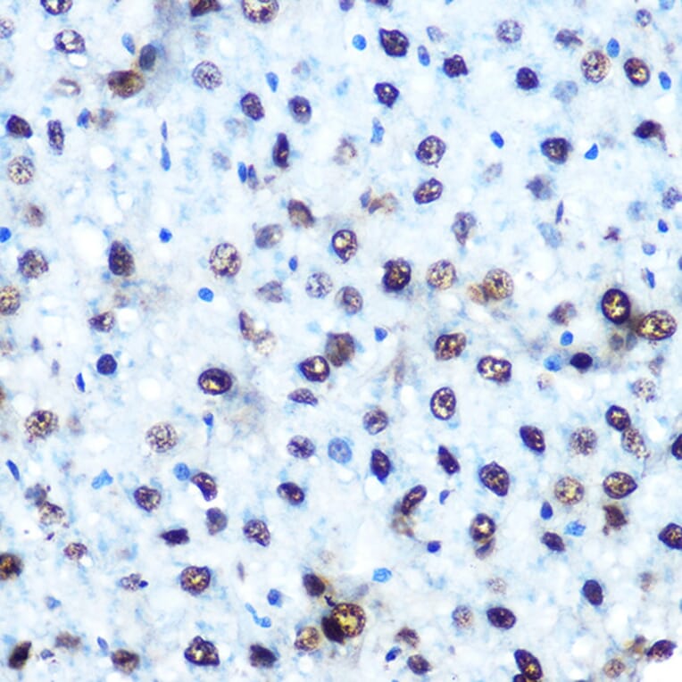 Immunohistochemistry - Anti-IRS1 (phospho Ser612) Antibody (A11031) - Antibodies.com