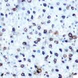 Immunohistochemistry - Anti-IRS1 (phospho Ser612) Antibody (A11031) - Antibodies.com