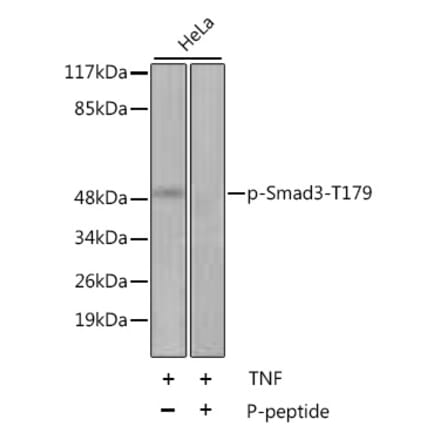 Western Blot - Anti-Smad3 (phospho Thr179) Antibody (A11032) - Antibodies.com