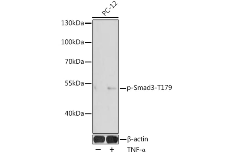 Western Blot - Anti-Smad3 (phospho Thr179) Antibody (A11032) - Antibodies.com