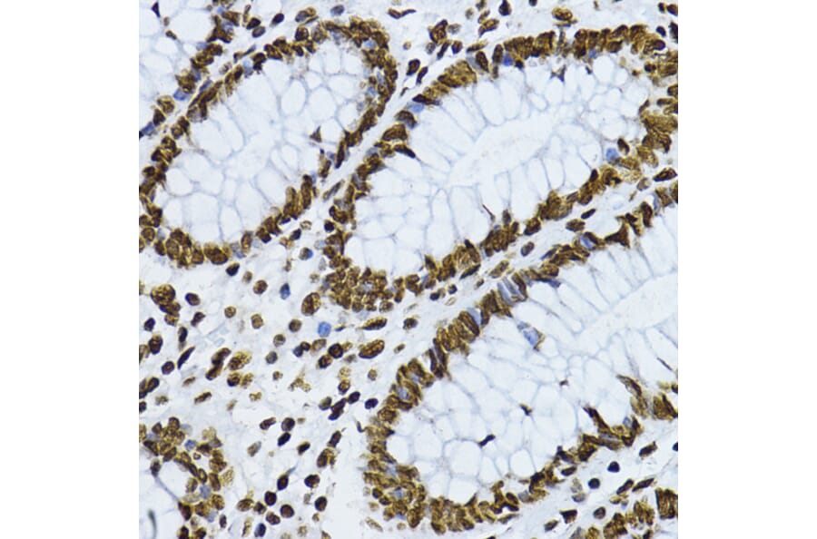 Immunohistochemistry - Anti-Smad3 (phospho Thr179) Antibody (A11032) - Antibodies.com