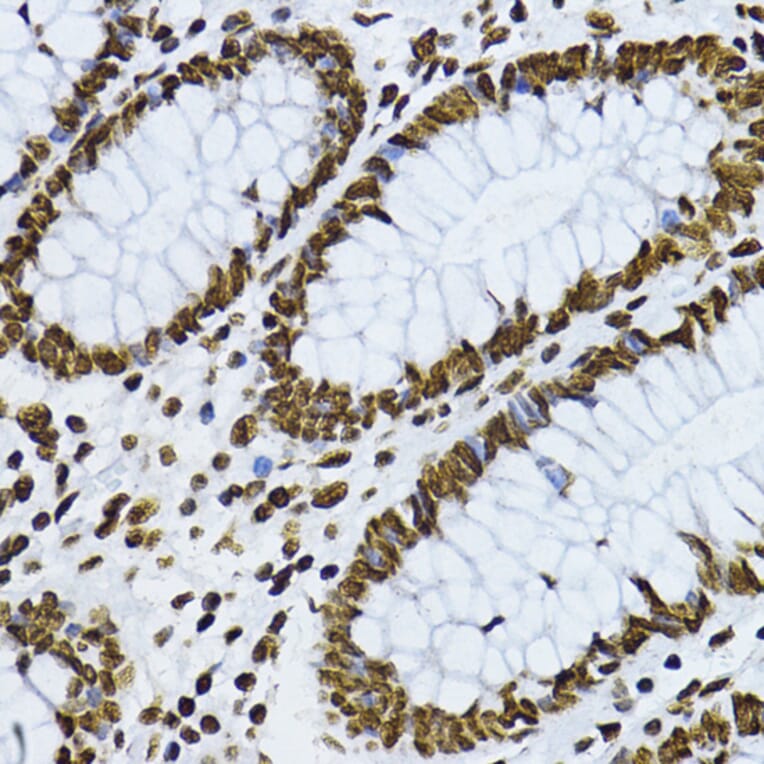 Immunohistochemistry - Anti-Smad3 (phospho Thr179) Antibody (A11032) - Antibodies.com