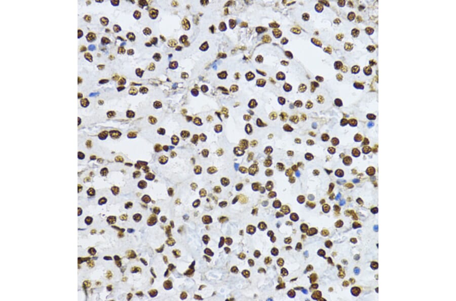 Immunohistochemistry - Anti-Smad3 (phospho Thr179) Antibody (A11032) - Antibodies.com