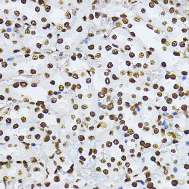 Immunohistochemistry - Anti-Smad3 (phospho Thr179) Antibody (A11032) - Antibodies.com