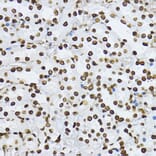 Immunohistochemistry - Anti-Smad3 (phospho Thr179) Antibody (A11032) - Antibodies.com