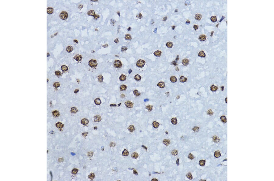 Immunohistochemistry - Anti-Smad3 (phospho Thr179) Antibody (A11032) - Antibodies.com