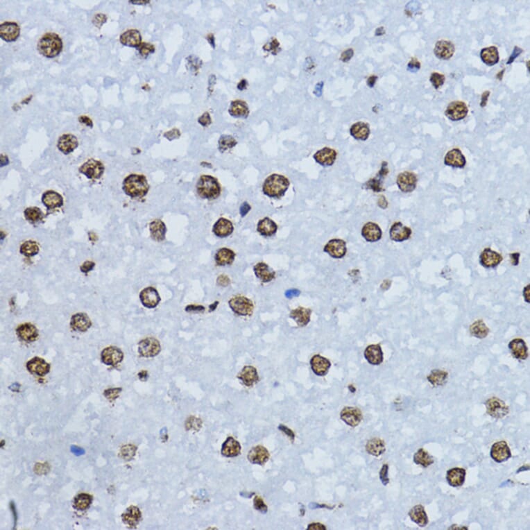Immunohistochemistry - Anti-Smad3 (phospho Thr179) Antibody (A11032) - Antibodies.com