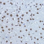 Immunohistochemistry - Anti-Smad3 (phospho Thr179) Antibody (A11032) - Antibodies.com
