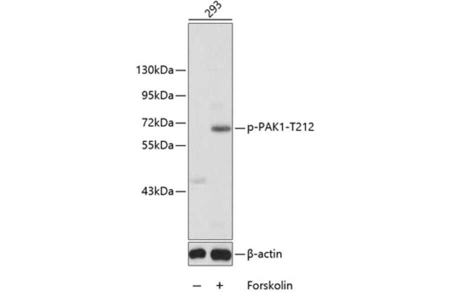 Western Blot - Anti-PAK1 (phospho T212) Antibody (AP0555) - Antibodies.com