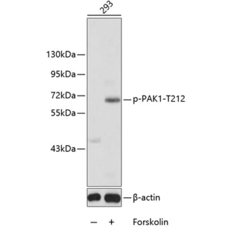 Western Blot - Anti-PAK1 (phospho T212) Antibody (AP0555) - Antibodies.com