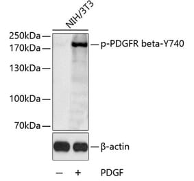 Western Blot - Anti-PDGFR beta (phospho Tyr740) Antibody (A11034) - Antibodies.com