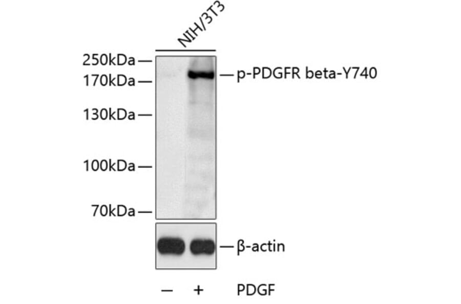 Western Blot - Anti-PDGFR beta (phospho Tyr740) Antibody (A11034) - Antibodies.com