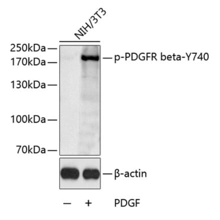 Western Blot - Anti-PDGFR beta (phospho Tyr740) Antibody (A11034) - Antibodies.com