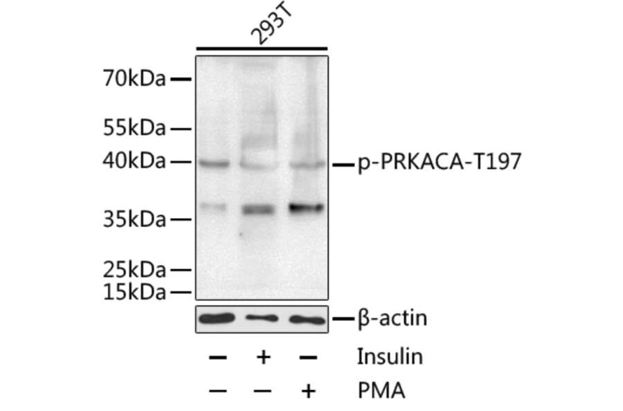 Western Blot - Anti-cAMP Protein Kinase Catalytic subunit alpha (phospho Thr197) Antibody (A11035) - Antibodies.com