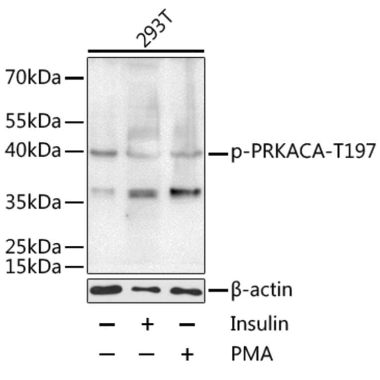 Western Blot - Anti-cAMP Protein Kinase Catalytic subunit alpha (phospho Thr197) Antibody (A11035) - Antibodies.com