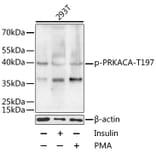 Western Blot - Anti-cAMP Protein Kinase Catalytic subunit alpha (phospho Thr197) Antibody (A11035) - Antibodies.com
