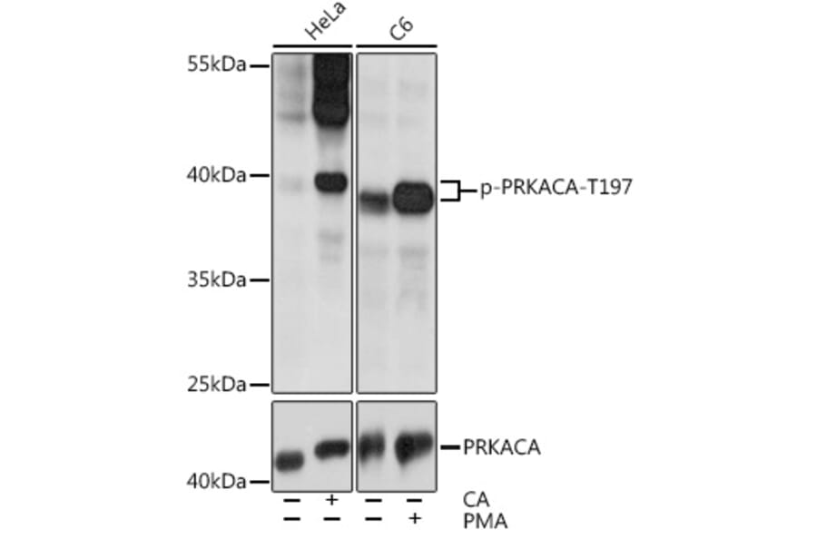 Western Blot - Anti-cAMP Protein Kinase Catalytic subunit alpha (phospho Thr197) Antibody (A11035) - Antibodies.com