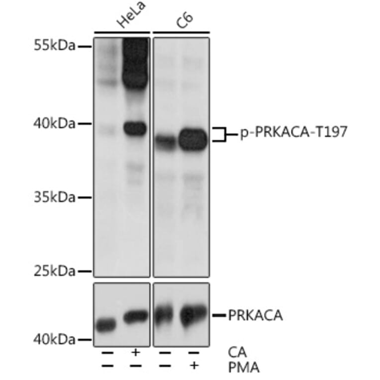 Western Blot - Anti-cAMP Protein Kinase Catalytic subunit alpha (phospho Thr197) Antibody (A11035) - Antibodies.com