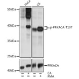 Western Blot - Anti-cAMP Protein Kinase Catalytic subunit alpha (phospho Thr197) Antibody (A11035) - Antibodies.com