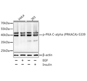 Western Blot - Anti-cAMP Protein Kinase Catalytic subunit (Phospho S339) Antibody (A11036) - Antibodies.com