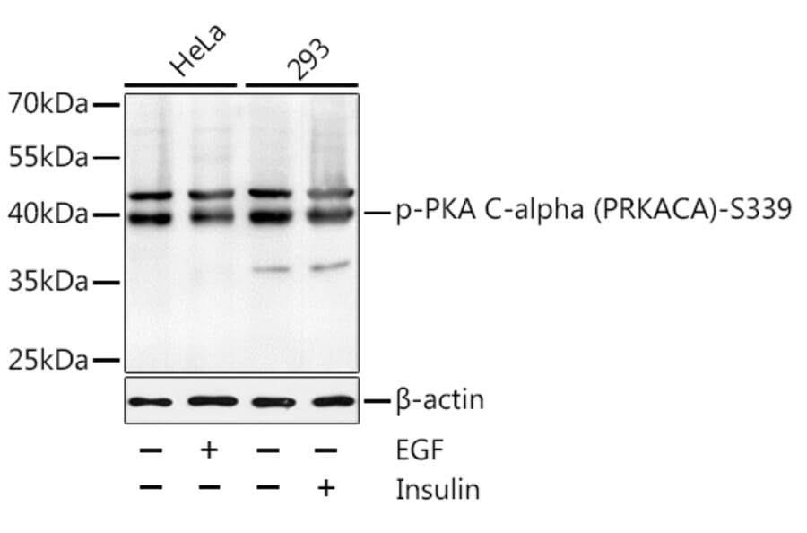 Western Blot - Anti-cAMP Protein Kinase Catalytic subunit (Phospho S339) Antibody (A11036) - Antibodies.com
