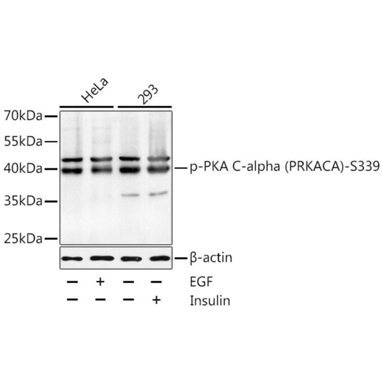 Western Blot - Anti-cAMP Protein Kinase Catalytic subunit (Phospho S339) Antibody (A11036) - Antibodies.com