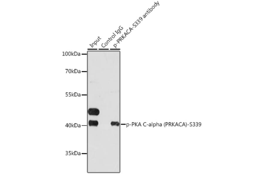Immunoprecipitation - Anti-cAMP Protein Kinase Catalytic subunit (Phospho S339) Antibody (A11036) - Antibodies.com