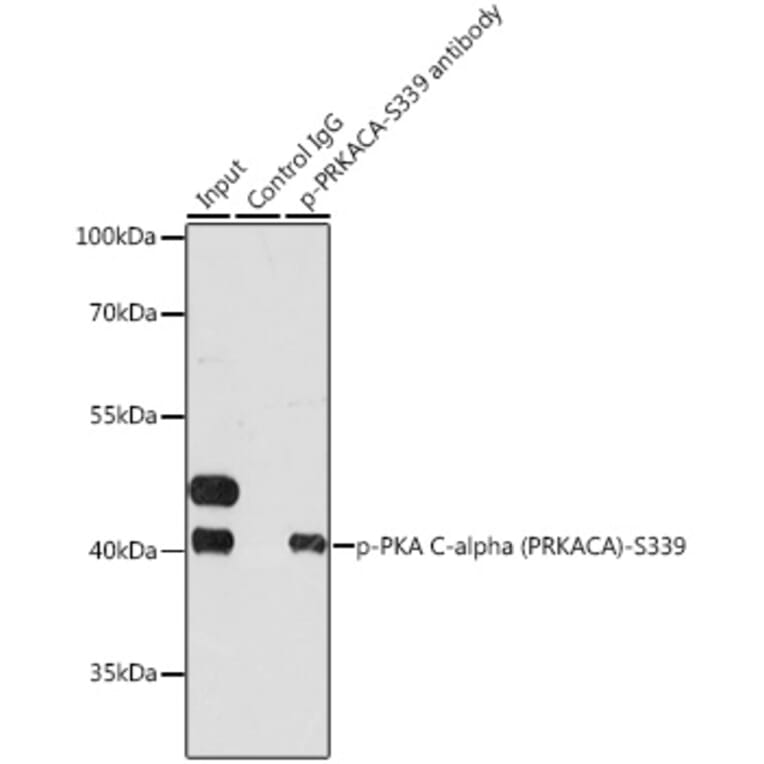 Immunoprecipitation - Anti-cAMP Protein Kinase Catalytic subunit (Phospho S339) Antibody (A11036) - Antibodies.com