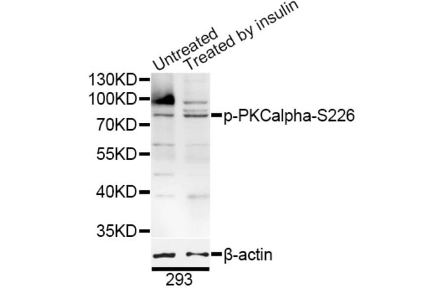 Western Blot - Anti-PKC alpha (phospho S226) Antibody (AP0559) - Antibodies.com