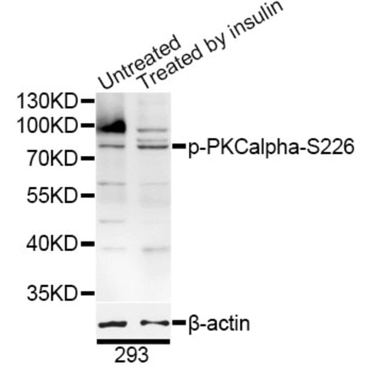 Western Blot - Anti-PKC alpha (phospho S226) Antibody (AP0559) - Antibodies.com