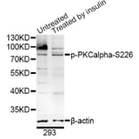 Western Blot - Anti-PKC alpha (phospho S226) Antibody (AP0559) - Antibodies.com
