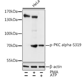 Western Blot - Anti-PKC alpha (phospho Ser319) Antibody (A11038) - Antibodies.com