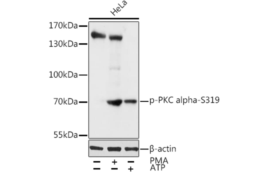 Western Blot - Anti-PKC alpha (phospho Ser319) Antibody (A11038) - Antibodies.com