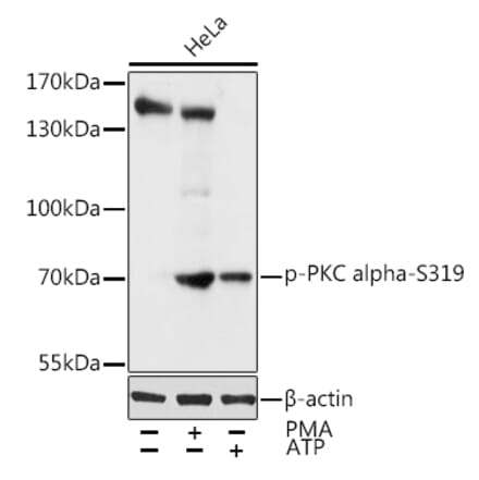 Western Blot - Anti-PKC alpha (phospho Ser319) Antibody (A11038) - Antibodies.com