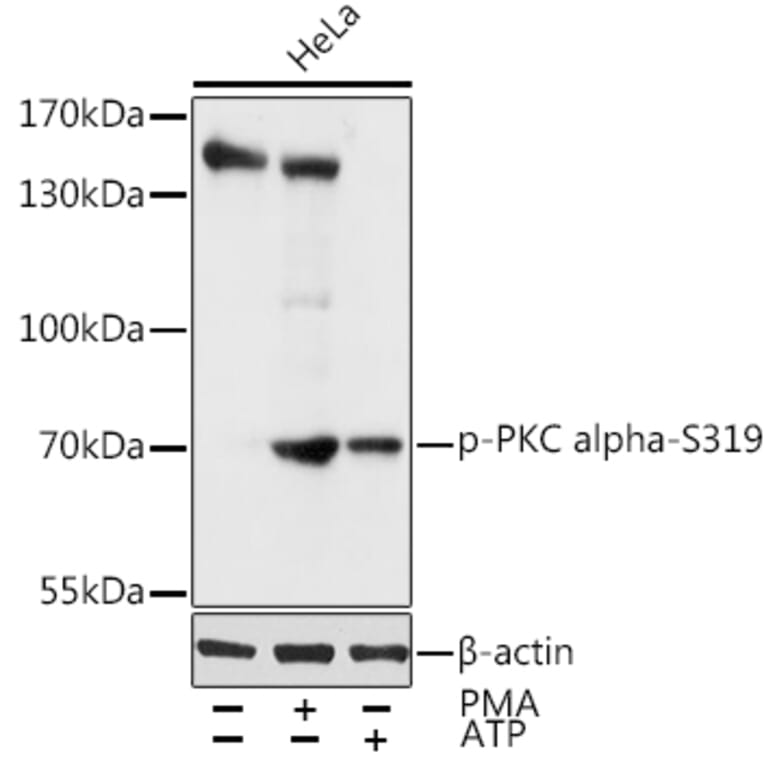 Western Blot - Anti-PKC alpha (phospho Ser319) Antibody (A11038) - Antibodies.com