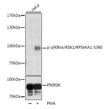 Western Blot - Anti-RSK1 p90 (phospho Ser380) Antibody (A11040) - Antibodies.com