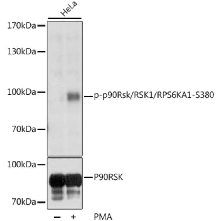 Western Blot - Anti-RSK1 p90 (phospho Ser380) Antibody (A11040) - Antibodies.com