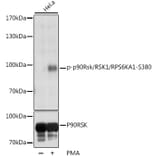 Western Blot - Anti-RSK1 p90 (phospho Ser380) Antibody (A11040) - Antibodies.com