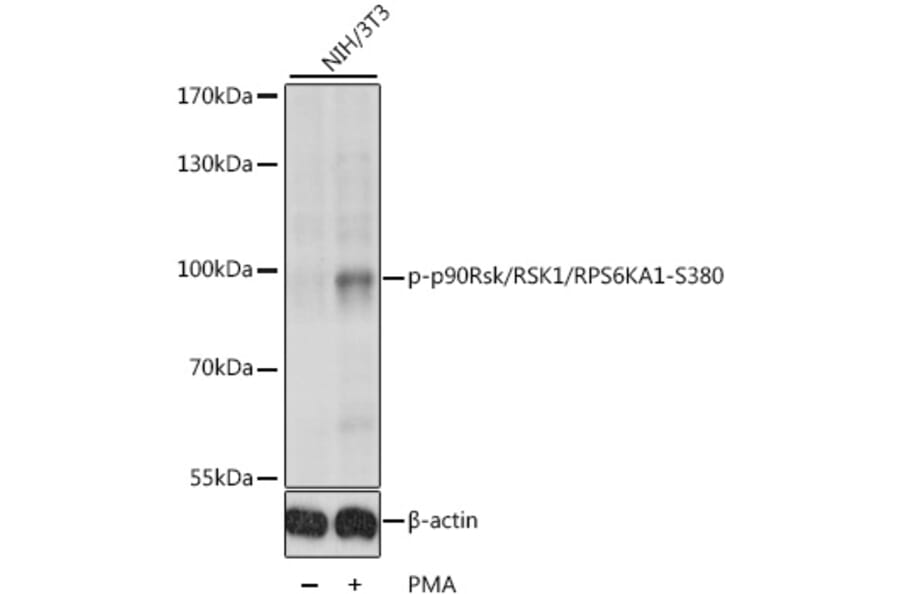 Western Blot - Anti-RSK1 p90 (phospho Ser380) Antibody (A11040) - Antibodies.com