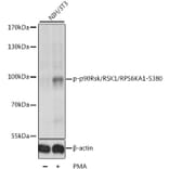 Western Blot - Anti-RSK1 p90 (phospho Ser380) Antibody (A11040) - Antibodies.com