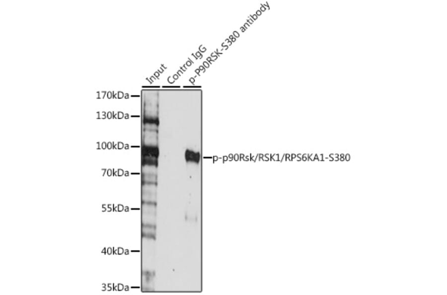Western Blot - Anti-RSK1 p90 (phospho Ser380) Antibody (A11040) - Antibodies.com