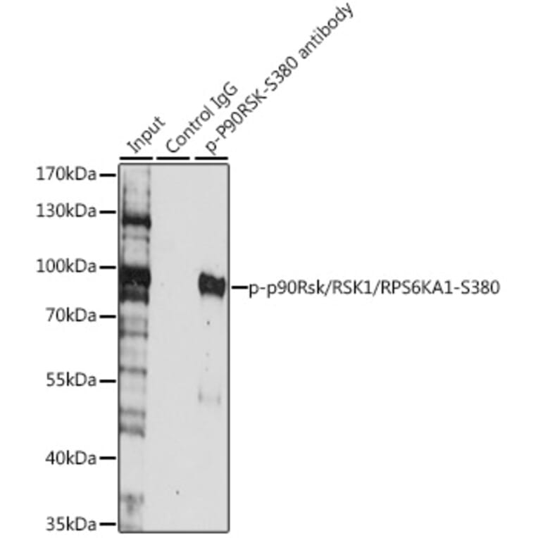 Western Blot - Anti-RSK1 p90 (phospho Ser380) Antibody (A11040) - Antibodies.com