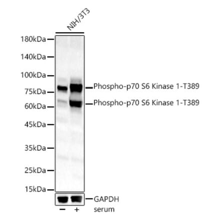 Western Blot - Anti-S6K1 (phospho Thr389) Antibody (A11042) - Antibodies.com
