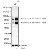 Western Blot - Anti-S6K1 (phospho Thr389) Antibody (A11042) - Antibodies.com