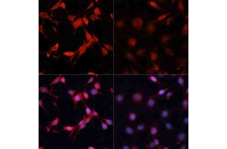 Immunofluorescence - Anti-S6K1 (phospho Thr389) Antibody (A11042) - Antibodies.com