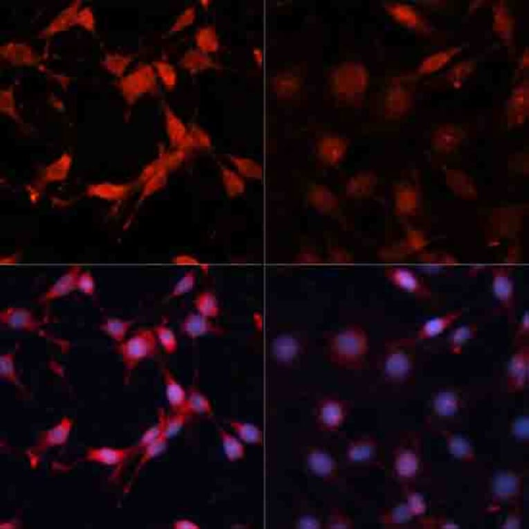 Immunofluorescence - Anti-S6K1 (phospho Thr389) Antibody (A11042) - Antibodies.com