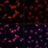 Immunofluorescence - Anti-S6K1 (phospho Thr389) Antibody (A11042) - Antibodies.com