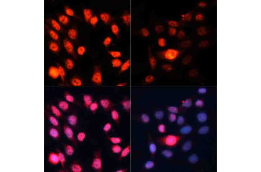 Immunofluorescence - Anti-S6K1 (phospho Thr389) Antibody (A11042) - Antibodies.com